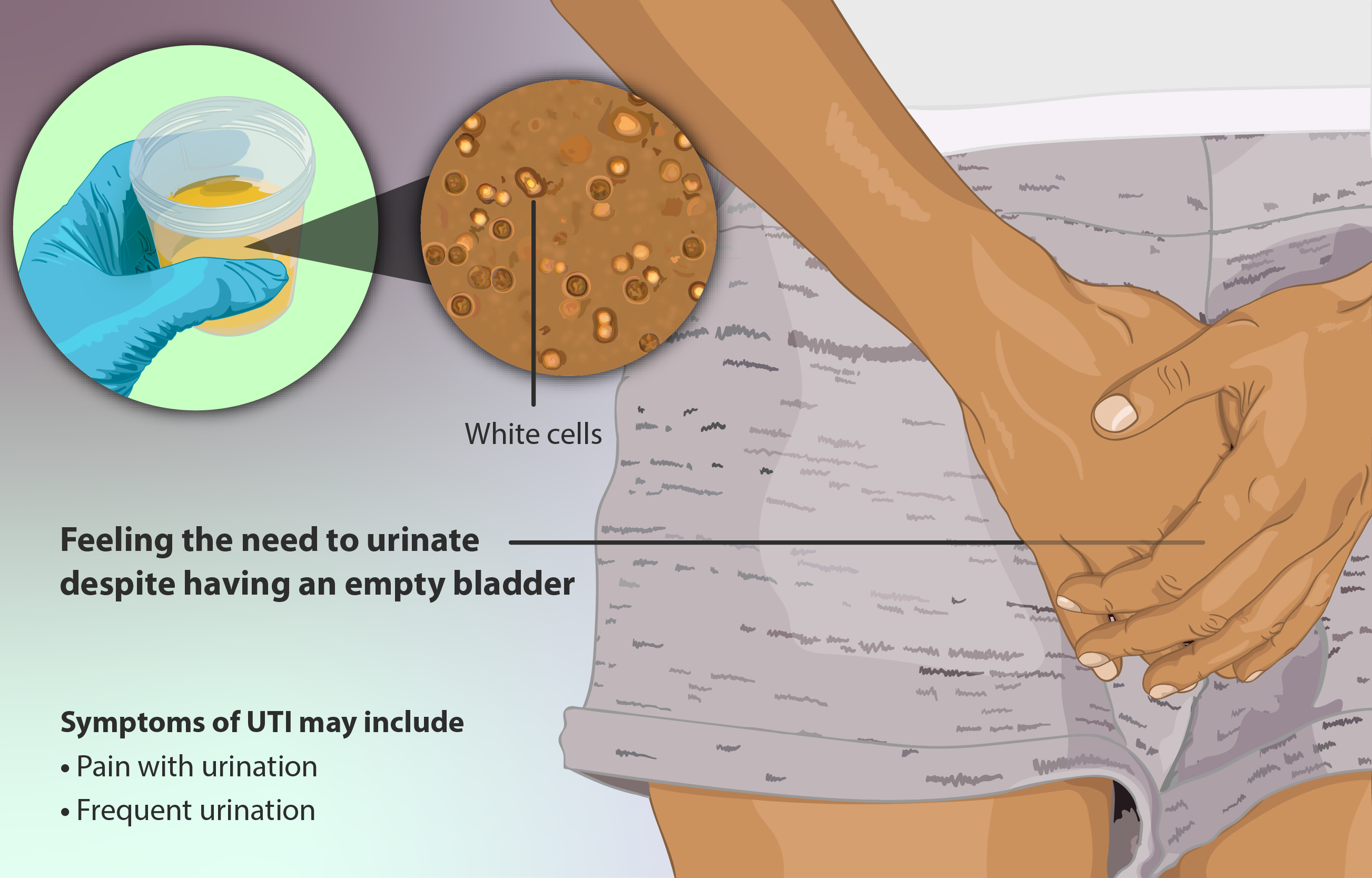 Poor access to reproductive services sparks UTI cases