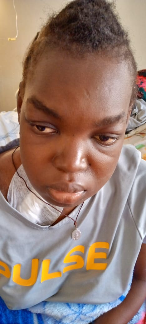 Donate now as Akurut Patricia, 23, needs an urgent kidney transplant in New Delhi
