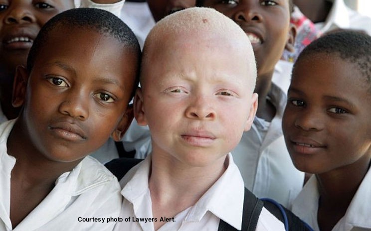 “Allow us in your schools” – appeals Lira learners with albinism